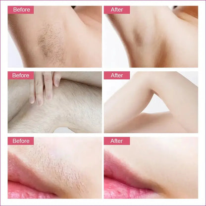 IPL Laser Hair Epilator Pro