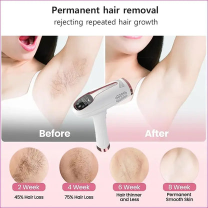 IPL Laser Hair Epilator Pro