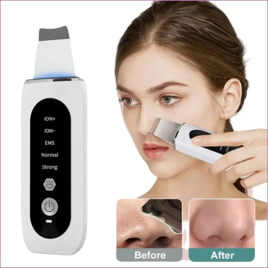 Ultrasonic Skin Blackhead Remover - White Kit with Gift